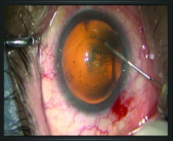 STELLA-OPH-MICROSCOPE-FLOOR-MOUNT,optinovate,optinovate-technologies,optical,optician,optometry,eyeclinic-equipment